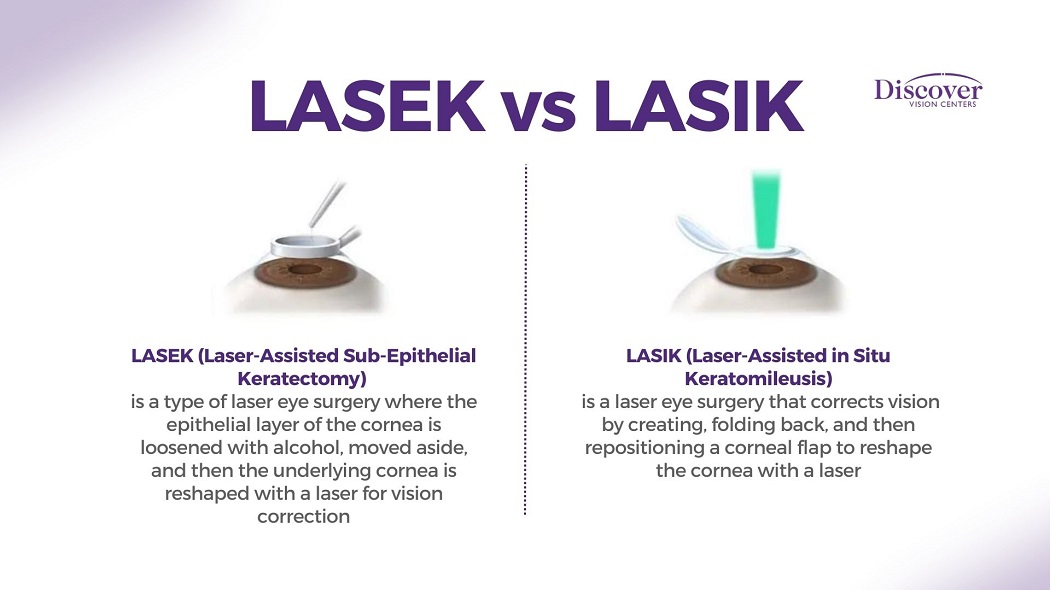 LASEK Vs LASIK What Is The Difference Discover Vision