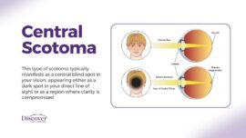 Scotoma: Blind Spot In Vision | Discover Vision