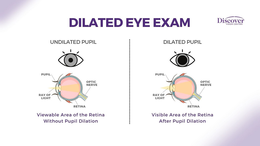 9 Types Of Eye Tests In Eye Exams Discover Vision 5978